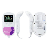 Contec Sonoline C Fetal Doppler